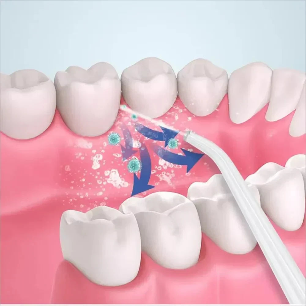 Nestify™3 In 1 Oral Irrigatorجهاز ري الفم 3 في 1